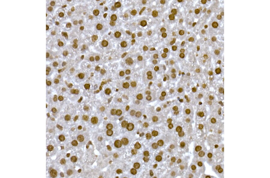 Immunohistochemistry - Anti-Histone H1.2 Antibody (A9176) - Antibodies.com