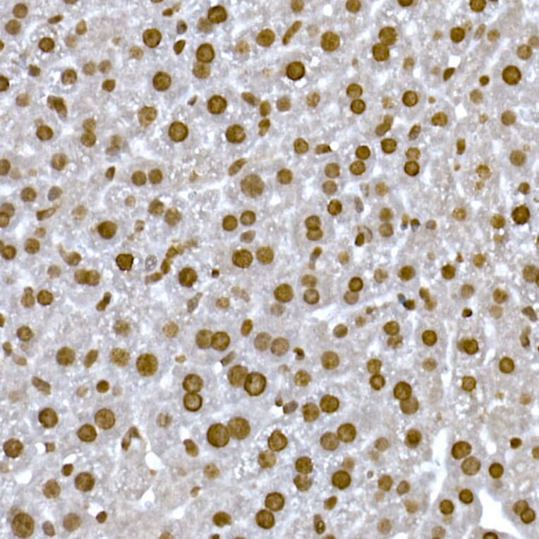 Immunohistochemistry - Anti-Histone H1.2 Antibody (A9176) - Antibodies.com