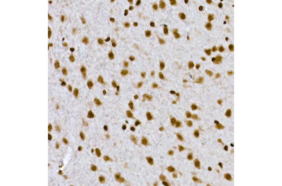 Immunohistochemistry - Anti-Histone H1.2 Antibody (A9176) - Antibodies.com