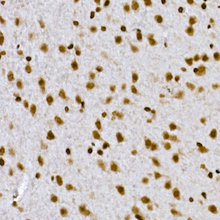 Immunohistochemistry - Anti-Histone H1.2 Antibody (A9176) - Antibodies.com