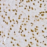 Immunohistochemistry - Anti-Histone H1.2 Antibody (A9176) - Antibodies.com