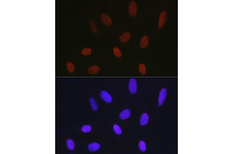 Immunofluorescence - Anti-Histone H1.2 Antibody (A9176) - Antibodies.com