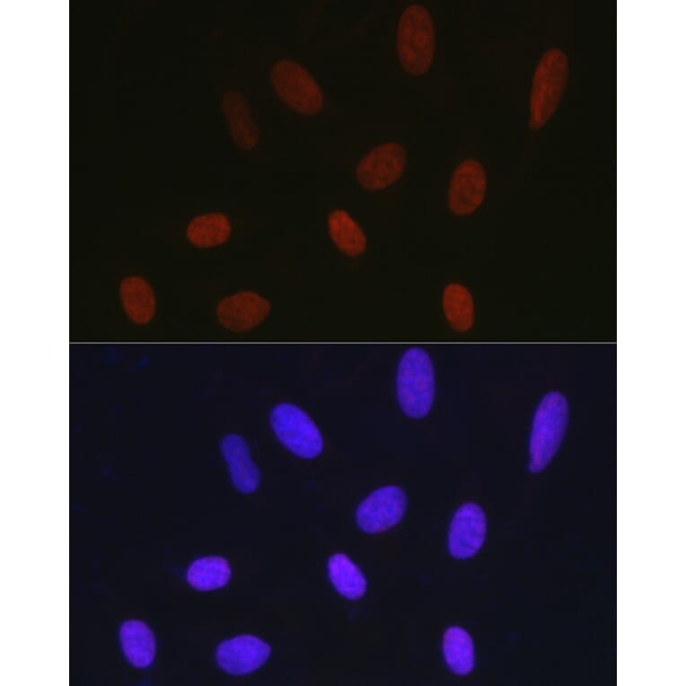 Immunofluorescence - Anti-Histone H1.2 Antibody (A9176) - Antibodies.com