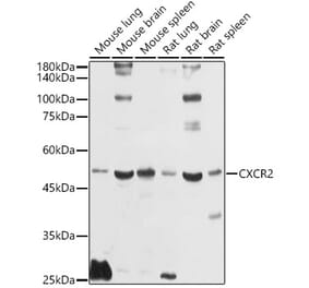 Western Blot - Anti-CXCR2 Antibody (A9177) - Antibodies.com