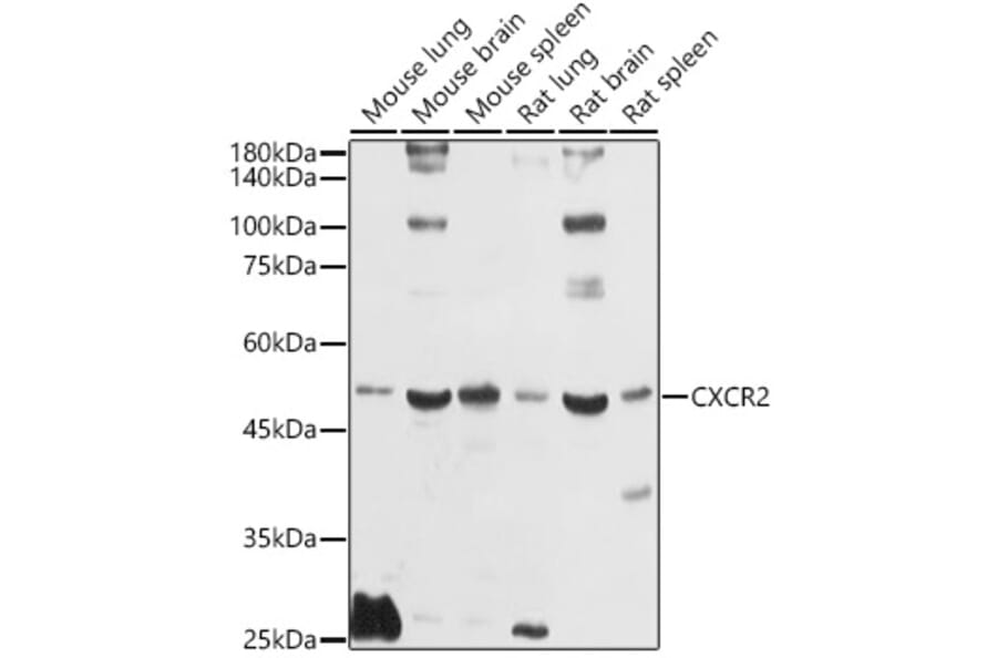 Western Blot - Anti-CXCR2 Antibody (A9177) - Antibodies.com