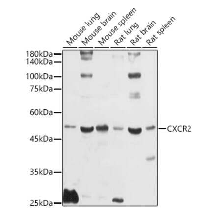 Western Blot - Anti-CXCR2 Antibody (A9177) - Antibodies.com
