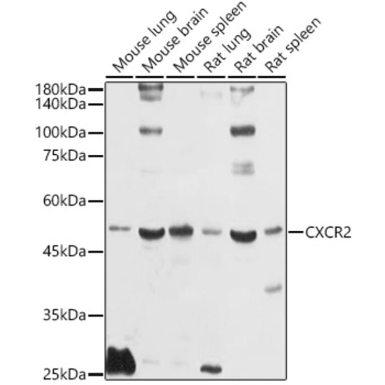Western Blot - Anti-CXCR2 Antibody (A9177) - Antibodies.com
