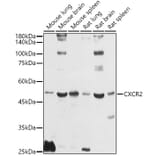 Western Blot - Anti-CXCR2 Antibody (A9177) - Antibodies.com