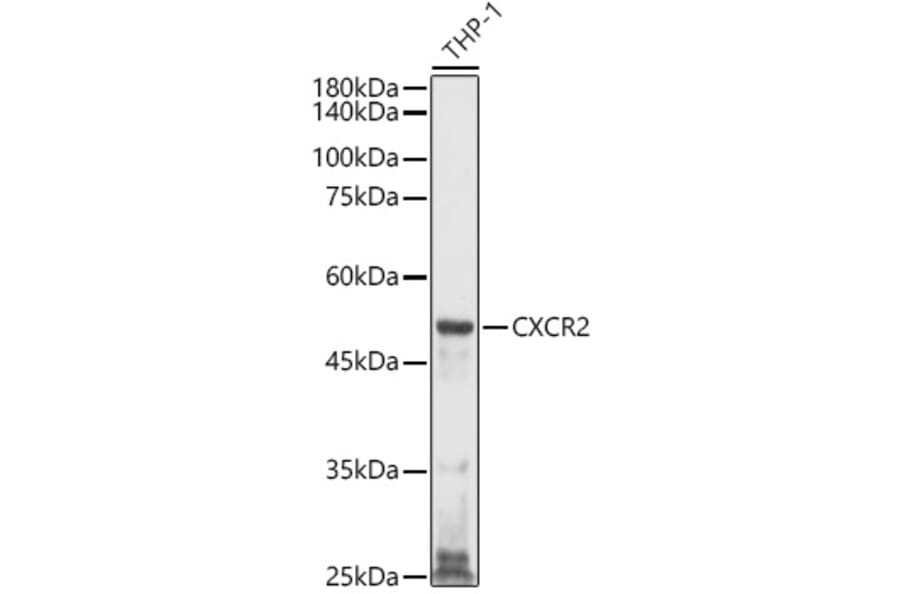 Western Blot - Anti-CXCR2 Antibody (A9177) - Antibodies.com