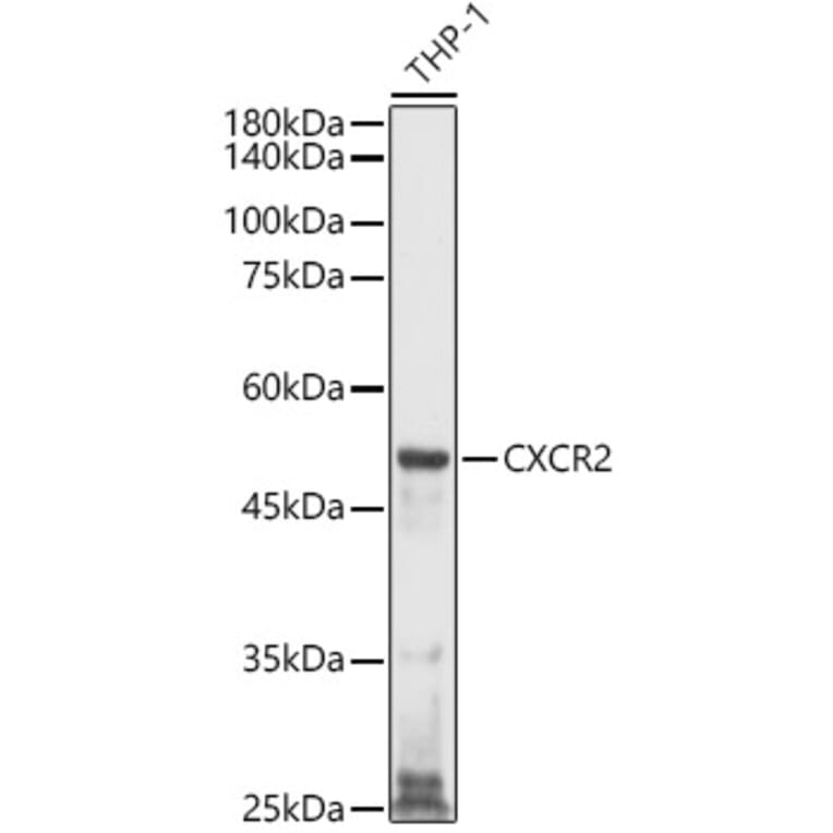 Western Blot - Anti-CXCR2 Antibody (A9177) - Antibodies.com