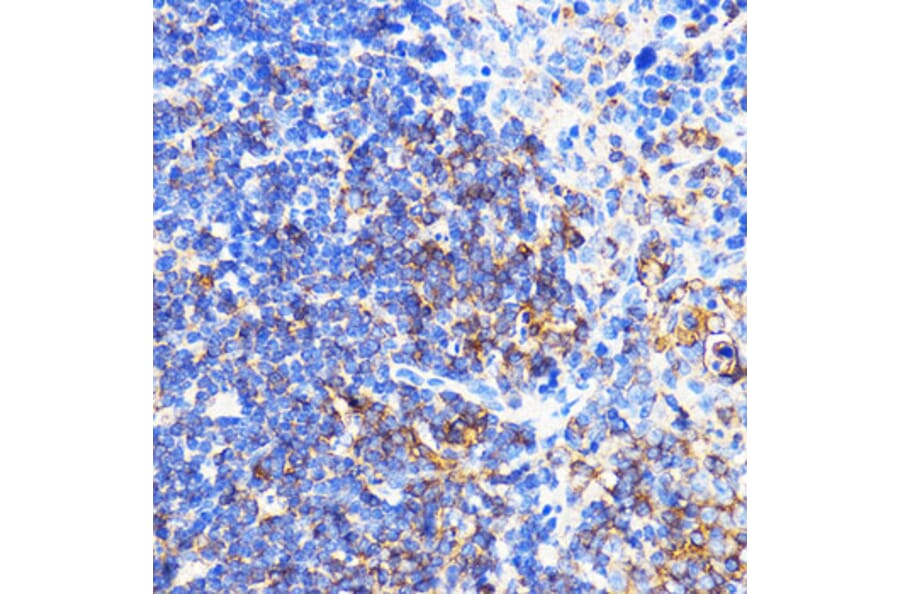Immunohistochemistry - Anti-CXCR2 Antibody (A9177) - Antibodies.com