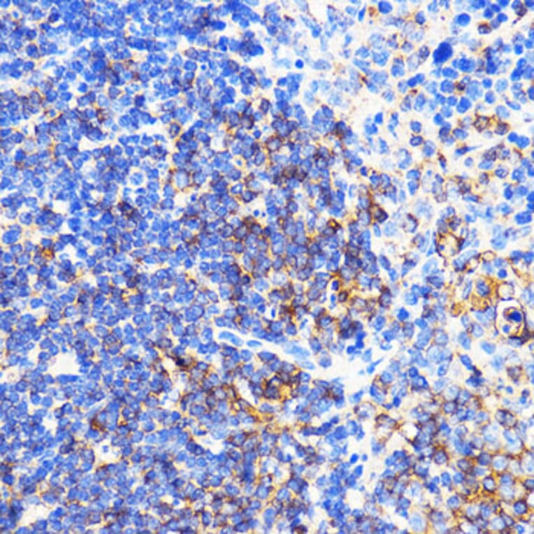 Immunohistochemistry - Anti-CXCR2 Antibody (A9177) - Antibodies.com