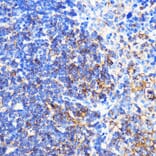 Immunohistochemistry - Anti-CXCR2 Antibody (A9177) - Antibodies.com