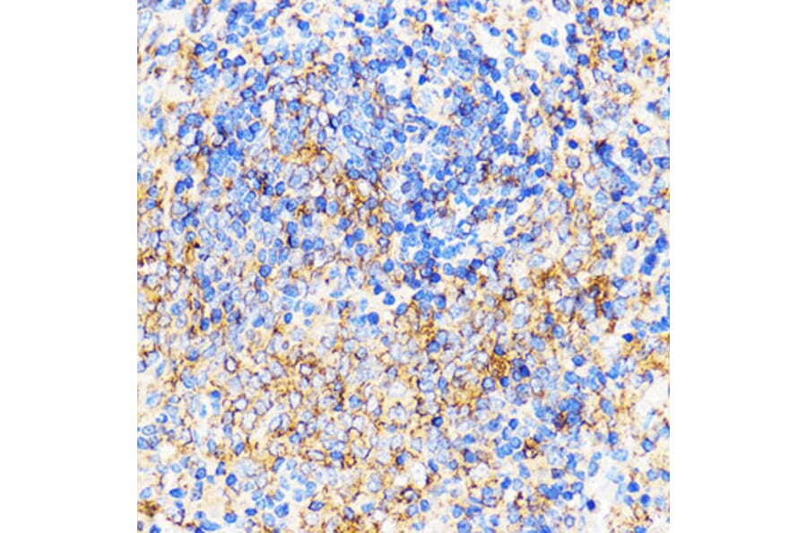 Immunohistochemistry - Anti-CXCR2 Antibody (A9177) - Antibodies.com