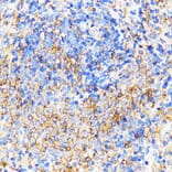 Immunohistochemistry - Anti-CXCR2 Antibody (A9177) - Antibodies.com