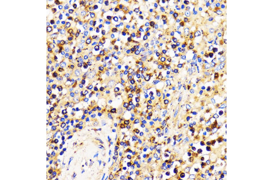 Immunohistochemistry - Anti-CXCR2 Antibody (A9177) - Antibodies.com