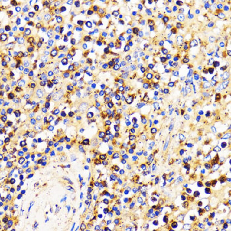 Immunohistochemistry - Anti-CXCR2 Antibody (A9177) - Antibodies.com