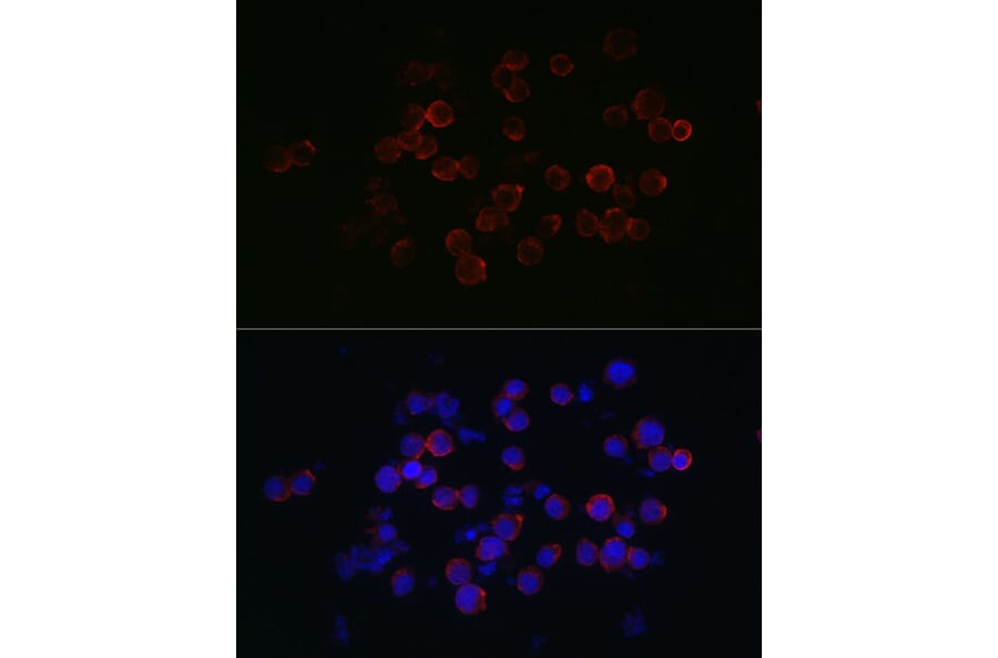 Immunofluorescence - Anti-CXCR2 Antibody (A9177) - Antibodies.com