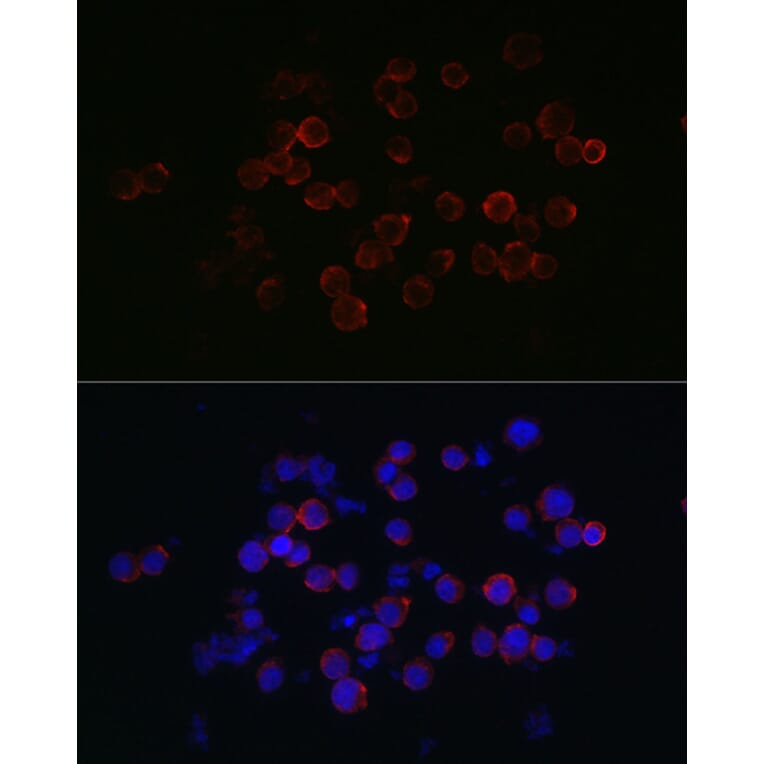 Immunofluorescence - Anti-CXCR2 Antibody (A9177) - Antibodies.com