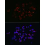 Immunofluorescence - Anti-CXCR2 Antibody (A9177) - Antibodies.com