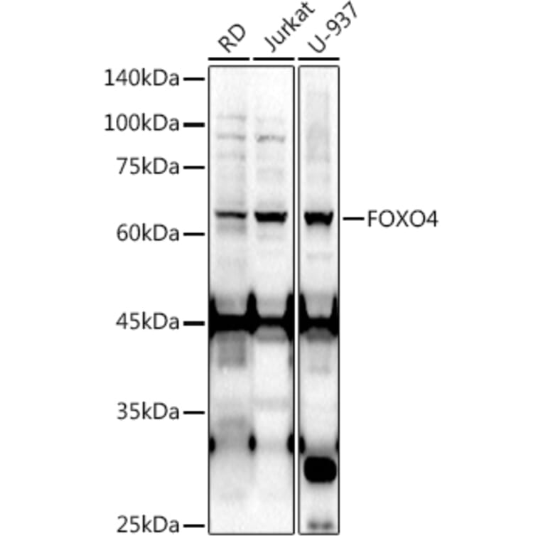 Western Blot - Anti-FOXO4/AFX Antibody (A9178) - Antibodies.com