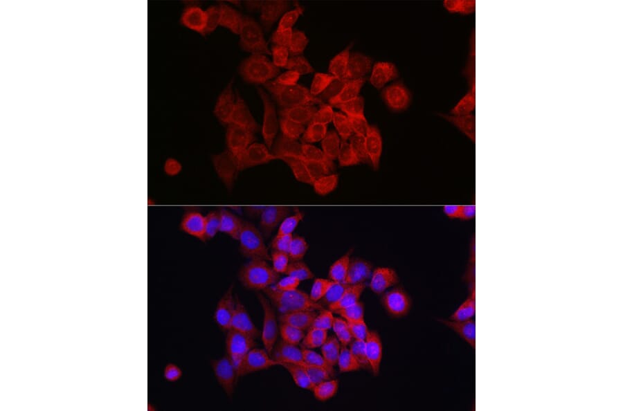 Immunofluorescence - Anti-FOXO4/AFX Antibody (A9178) - Antibodies.com