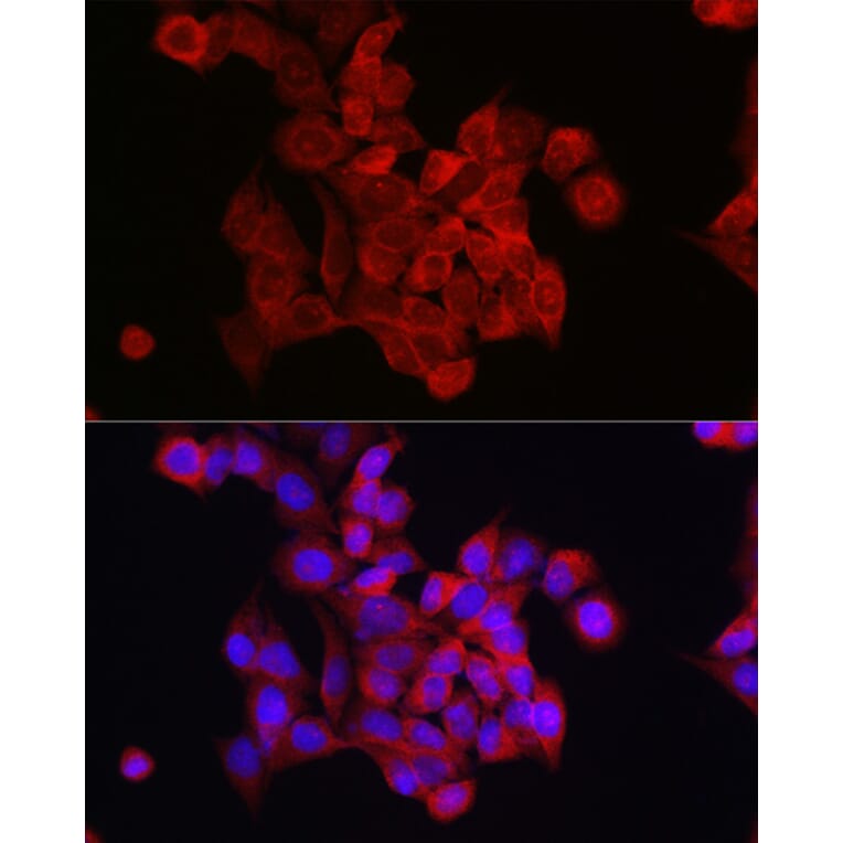 Immunofluorescence - Anti-FOXO4/AFX Antibody (A9178) - Antibodies.com