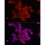 Immunofluorescence - Anti-FOXO4/AFX Antibody (A9178) - Antibodies.com