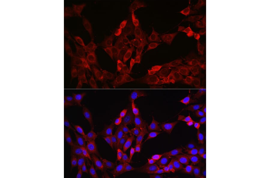 Immunofluorescence - Anti-FOXO4/AFX Antibody (A9178) - Antibodies.com
