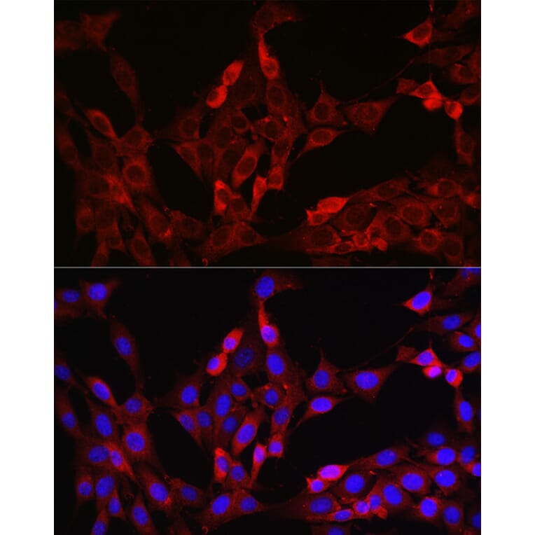 Immunofluorescence - Anti-FOXO4/AFX Antibody (A9178) - Antibodies.com
