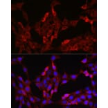 Immunofluorescence - Anti-FOXO4/AFX Antibody (A9178) - Antibodies.com