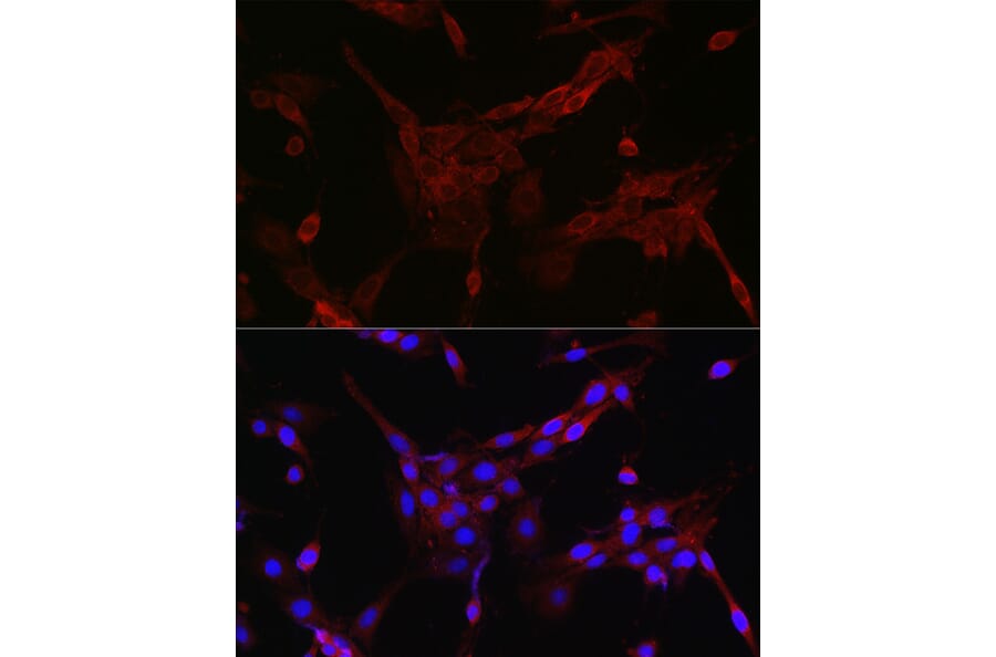 Immunofluorescence - Anti-FOXO4/AFX Antibody (A9178) - Antibodies.com