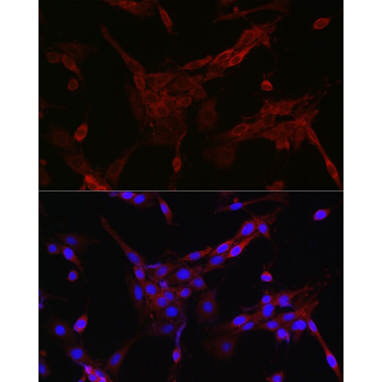 Immunofluorescence - Anti-FOXO4/AFX Antibody (A9178) - Antibodies.com