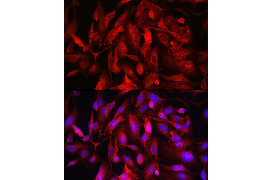 Immunofluorescence - Anti-FOXO4/AFX Antibody (A9178) - Antibodies.com
