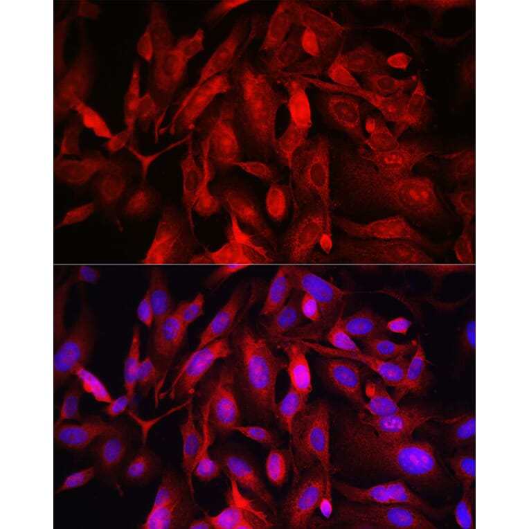 Immunofluorescence - Anti-FOXO4/AFX Antibody (A9178) - Antibodies.com