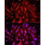 Immunofluorescence - Anti-FOXO4/AFX Antibody (A9178) - Antibodies.com