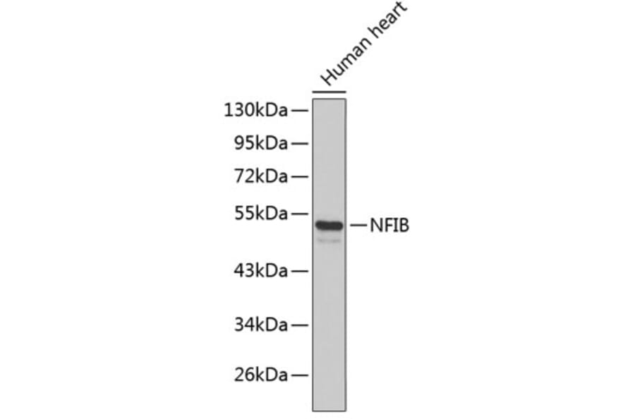 Western Blot - Anti-NFIB Antibody (A3314) - Antibodies.com