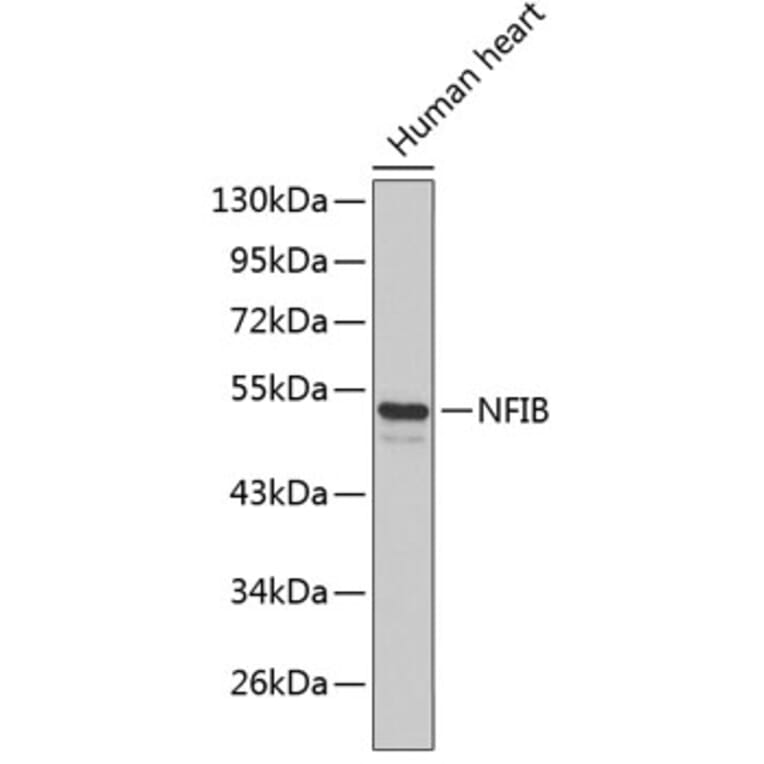 Western Blot - Anti-NFIB Antibody (A3314) - Antibodies.com