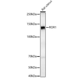 Western Blot - Anti-ROR1 Antibody (A9180) - Antibodies.com
