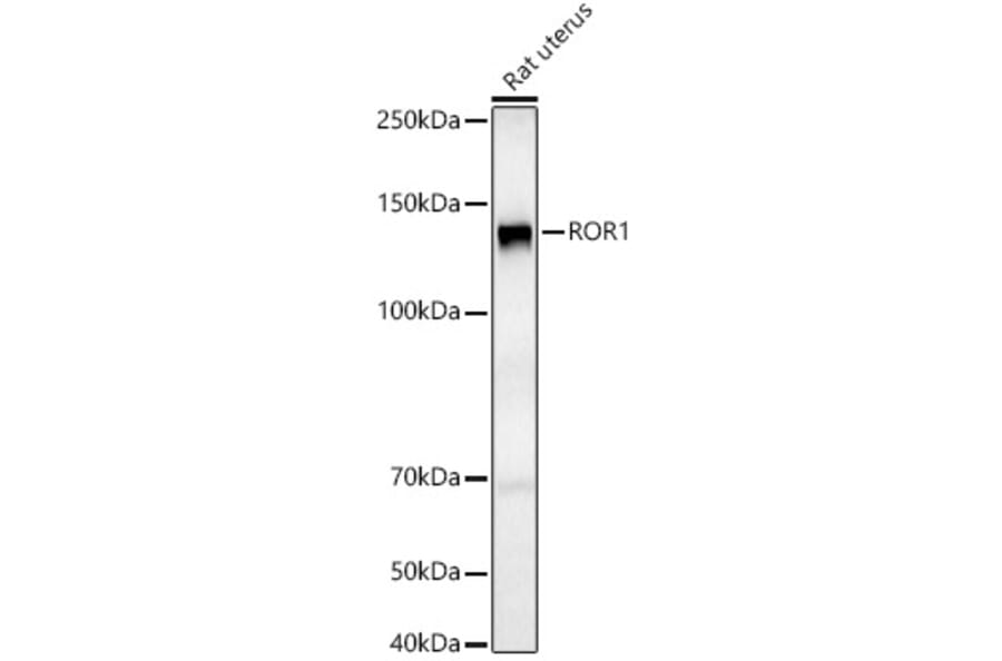 Western Blot - Anti-ROR1 Antibody (A9180) - Antibodies.com
