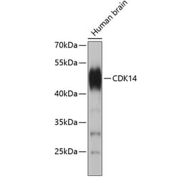 Western Blot - Anti-PFTK1 Antibody (A9181) - Antibodies.com