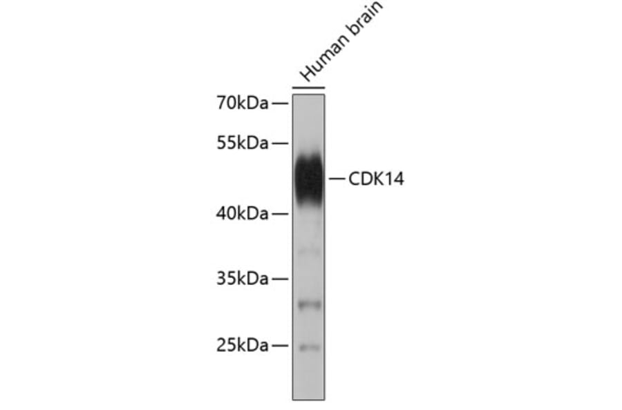 Western Blot - Anti-PFTK1 Antibody (A9181) - Antibodies.com
