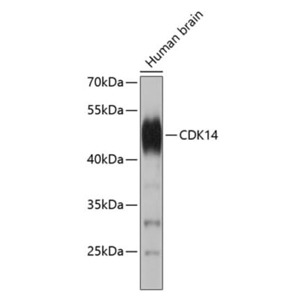 Western Blot - Anti-PFTK1 Antibody (A9181) - Antibodies.com