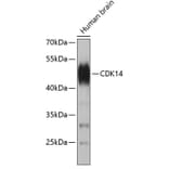Western Blot - Anti-PFTK1 Antibody (A9181) - Antibodies.com