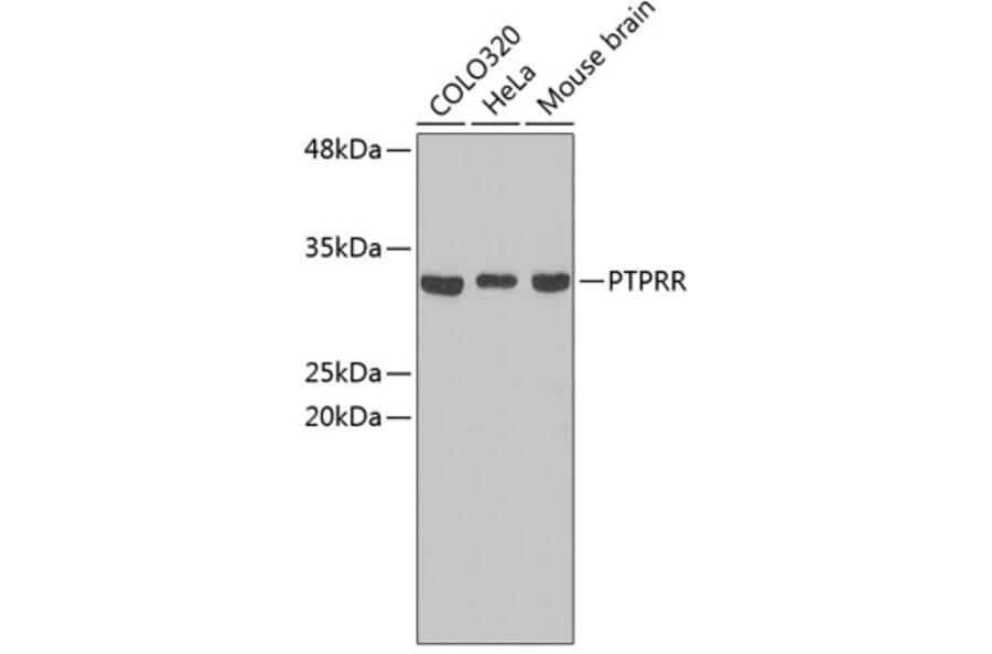 Western Blot - Anti-PTPRR Antibody (A3323) - Antibodies.com