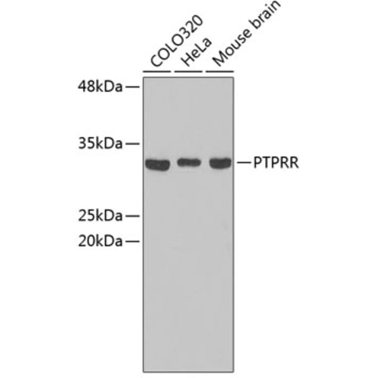 Western Blot - Anti-PTPRR Antibody (A3323) - Antibodies.com