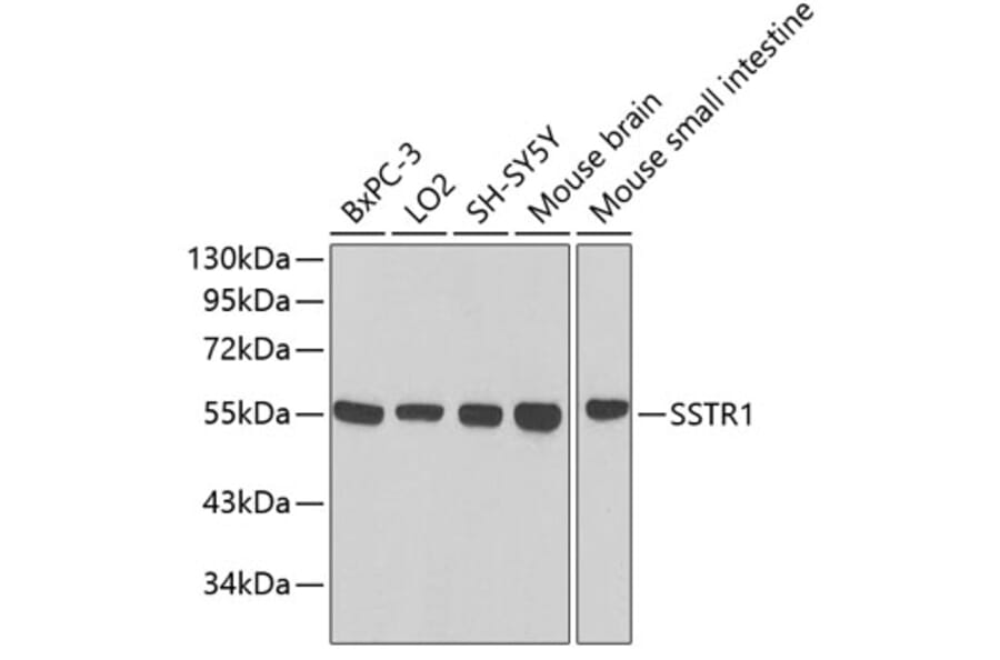 Western Blot - Anti-SSTR1 Antibody (A3332) - Antibodies.com