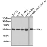 Western Blot - Anti-SSTR1 Antibody (A3332) - Antibodies.com