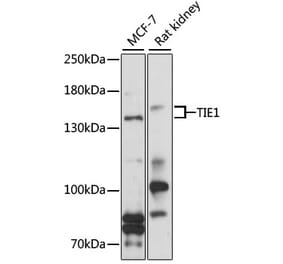 Western Blot - Anti-TIE1 Antibody (A9186) - Antibodies.com