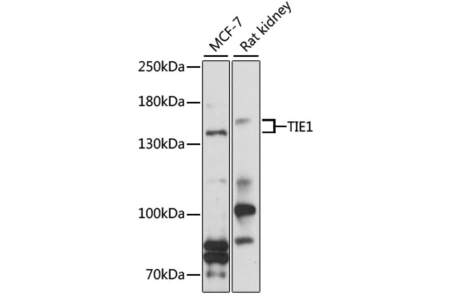 Western Blot - Anti-TIE1 Antibody (A9186) - Antibodies.com